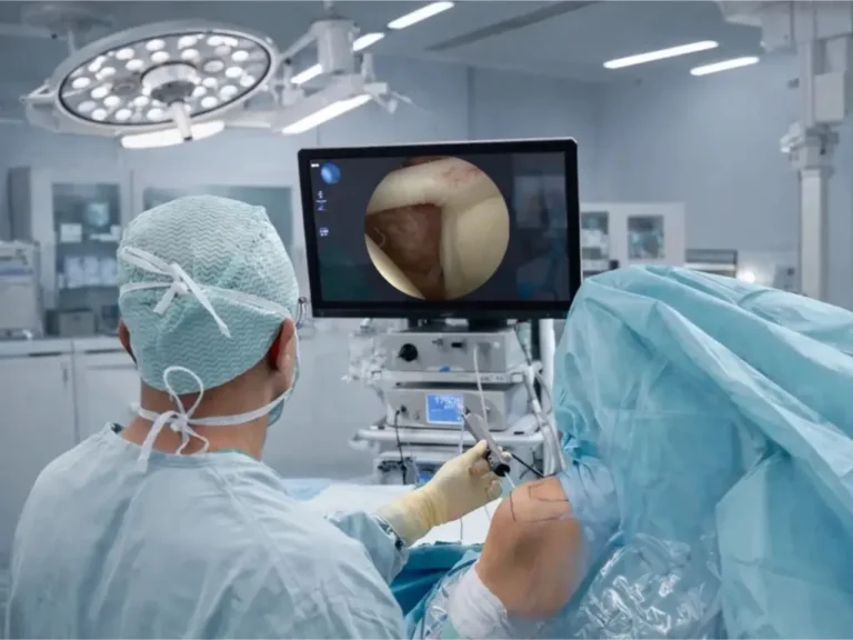 shoulder arthroscopy surgery Dubai minimally invasive shoulder surgery rotator cuff repair arthroscopy