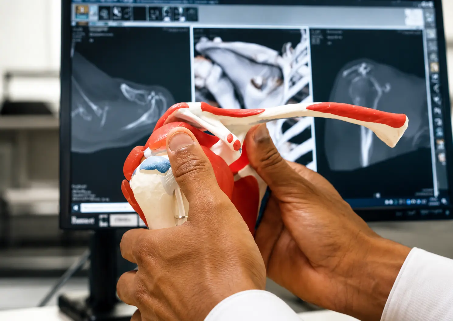 Hamo Kenawy, shoulder specialist in Dubai, holding an anatomical shoulder model in front of shoulder scans.
